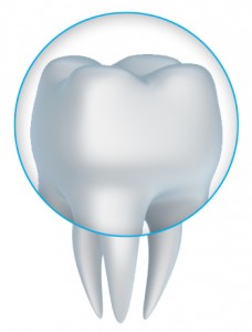 porcelain crowns dentist Jefferson City dentist