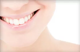 Advanced Teeth Whitening with a Jefferson City dentist California MO