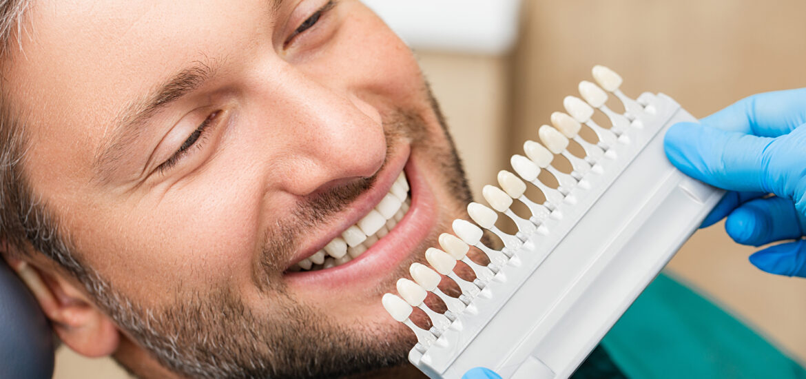man smiling as he is shown color palette for a cosmetic procedure