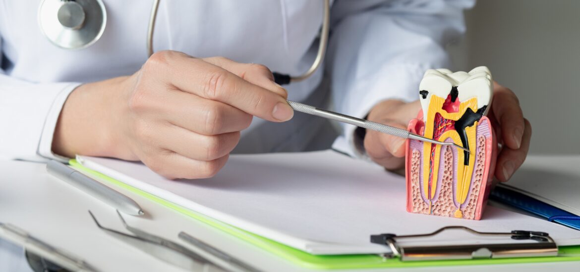 dentist showing the tooth infection and the formation of the tooth pulp