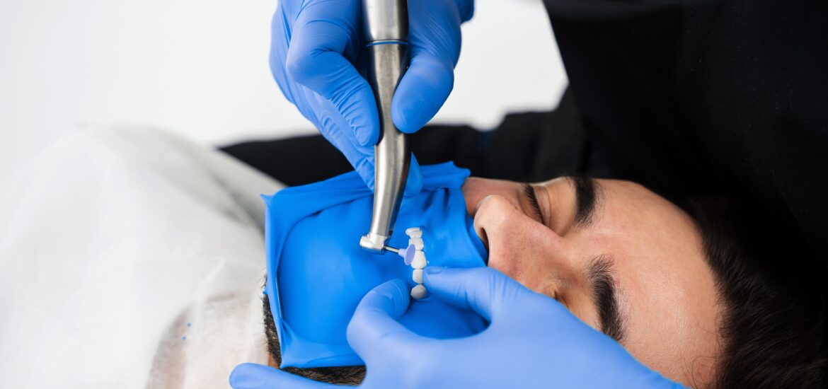 Dentist isolates teeth using dental dam to prepare them for veneers installation