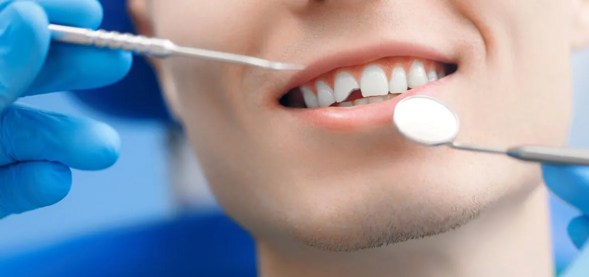 closeup of chipped front tooth