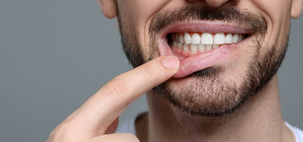 closeup of a man pulling down his lip exposing healthy gums